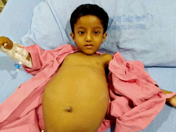 My son holds his stomach tight and cries out loudly in pain. He drains