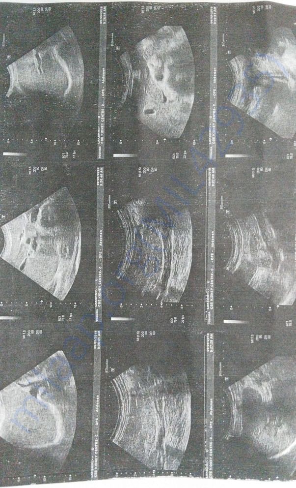 Scan Report