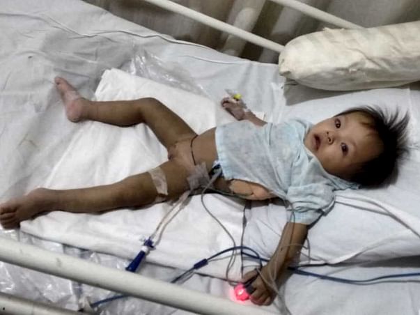 Save Rachel: HELP 10 month old baby from Manipur with fluid in Lungs.