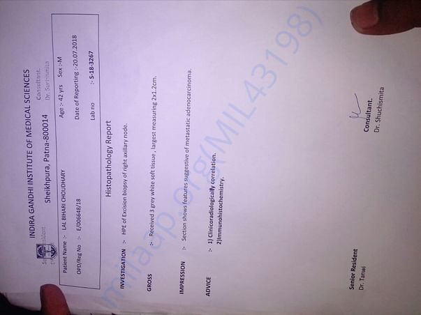 Surgeries Biopsy