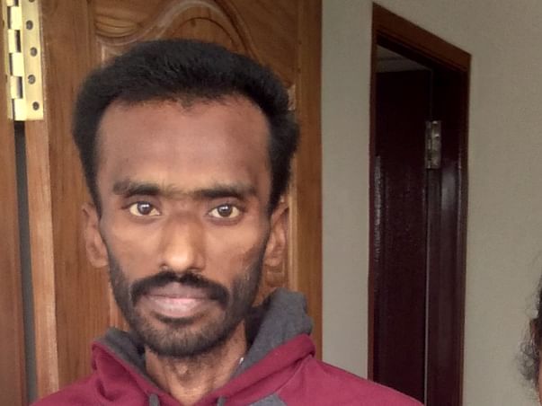 Help Sivakumar to undergo Surgery - Gastrojejunostomy