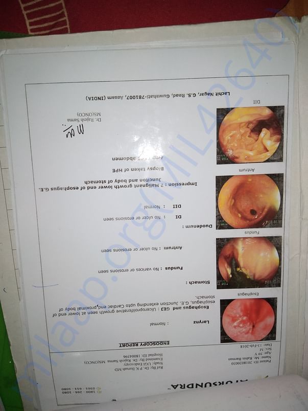 Endoscopy