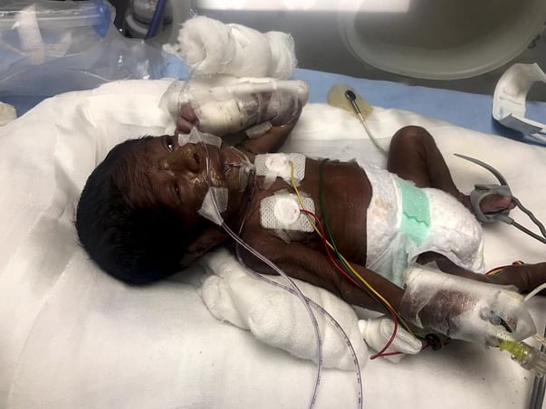 Help Prematurely Born Baby Fighting For Life.