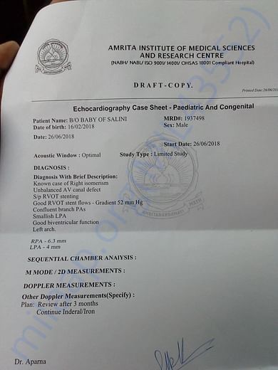 echocardiography of baby