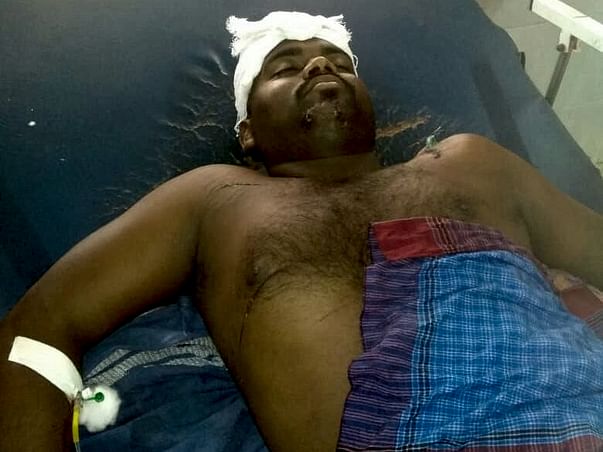 Fund Raising For Manikandan Brain Surgery