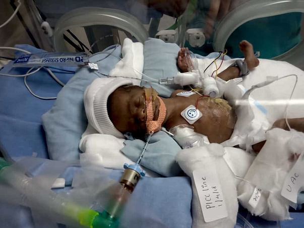 Help my premature baby who is struggling in ICU