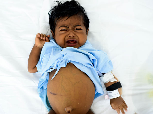 Support Baby Abhinand To Undergo a Liver Transplant