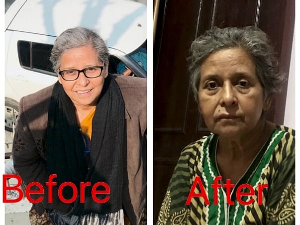 Help Basant Shobha For Fight With Hodgkin's Lymphadinitis Cancer