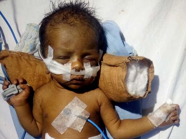 This 18-day-old baby cannot breathe and needs your help to live