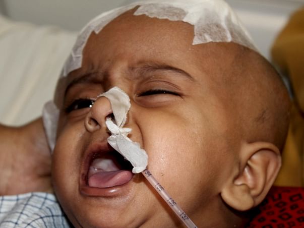 10-Month-Old Needs Treatment To Heal From Brain Injury