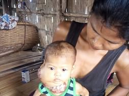 Help Baby Kaokuchangti Fight Against deadly Arteriovenous
