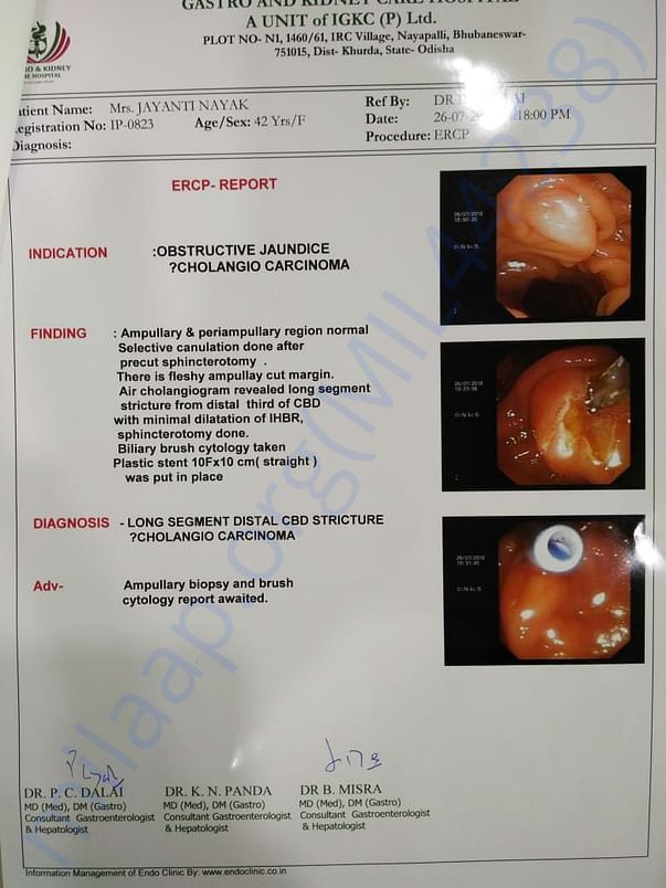 ERCP report