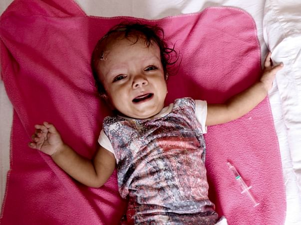 Daily Wager Struggles To Save 9-Month-Old From Brain Tumor