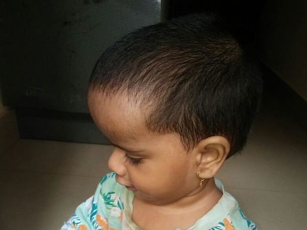 Help Ganesh Treat His Son's Hydrocephalus