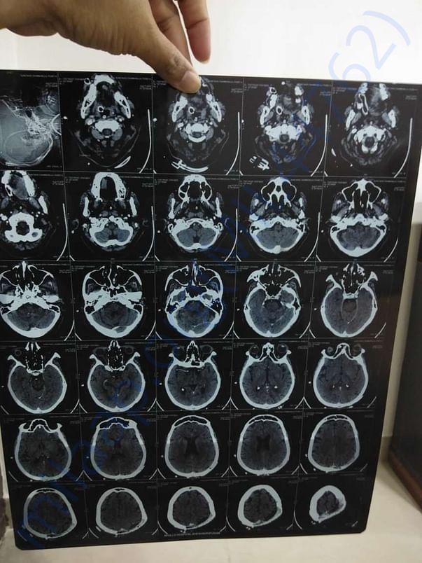 Brain scan
