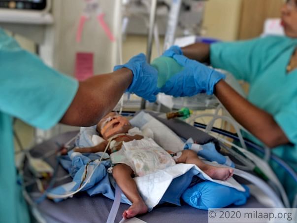 Parents Who Have Already Lost A Child Struggle To Save 1-Month-Old