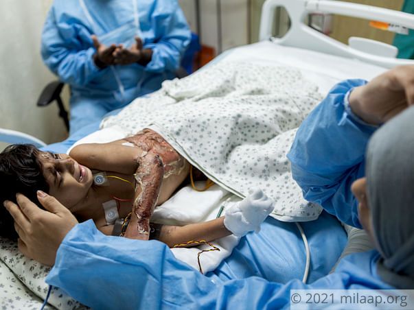 3-Year-Old Suffers From Severe Burns After Falling Into Boiling Water