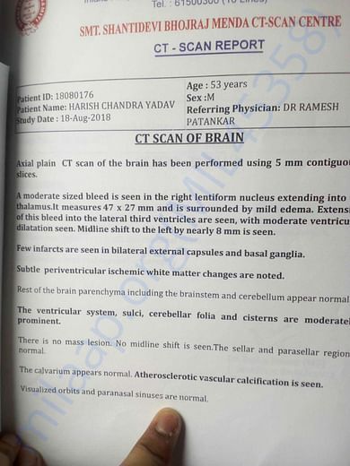 Reports of CT Scan of Brain