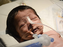 This 7-Day-Old Baby Who Cannot Breathe Needs Surgery Urgently