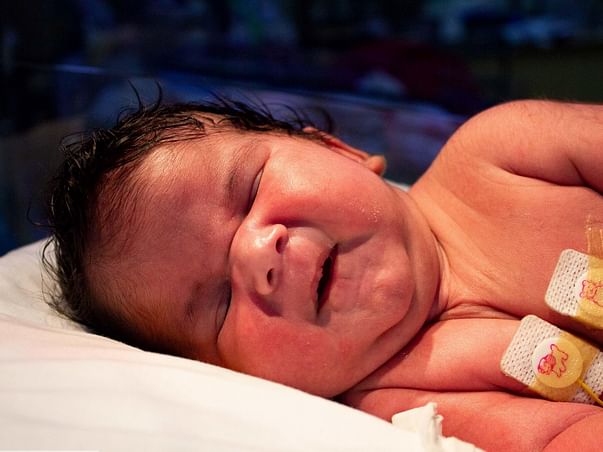 15-day-old baby with hole in the back needs urgent surgery
