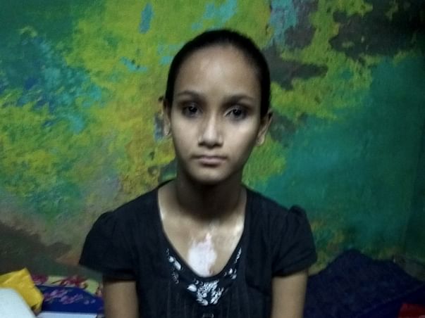 Raise Your Hands To Help Rohini (13yrs) Suffering From Heart Disease