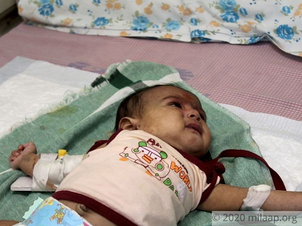 Every Passing Minute Is Crucial To 1-Month-Old Baby Without Treatment