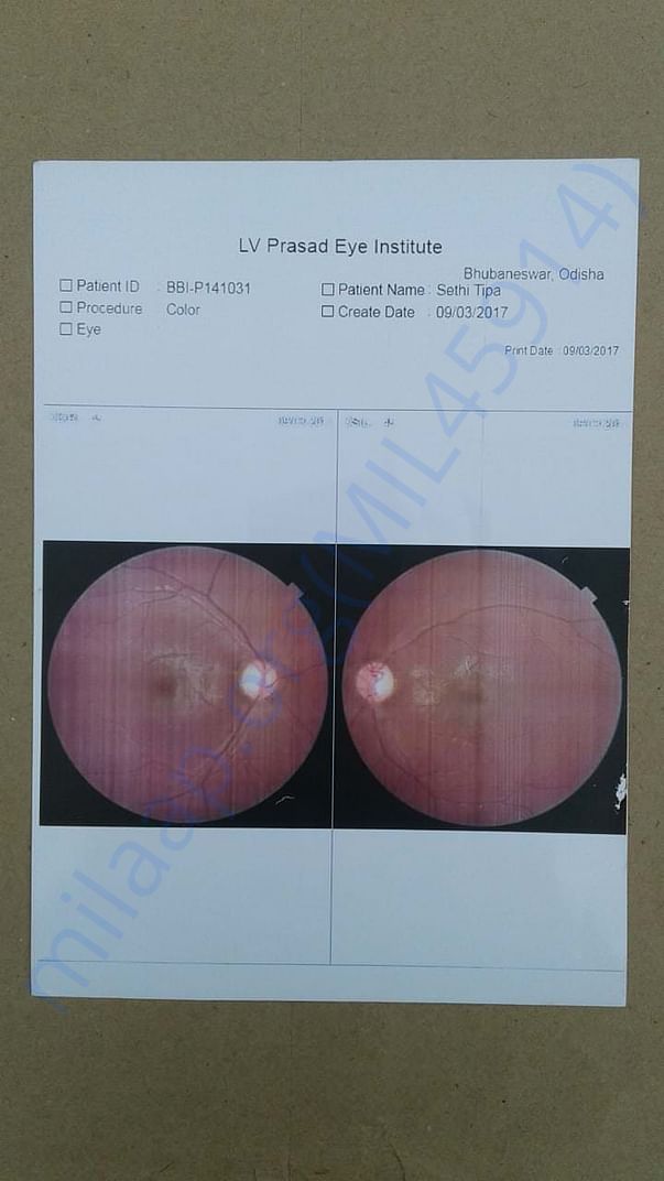 eyesight checkup report