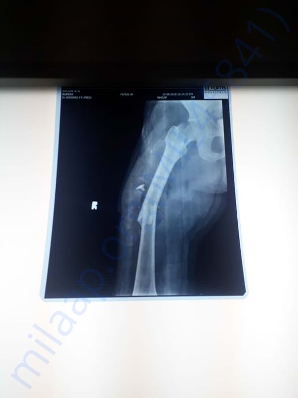 X-ray 1