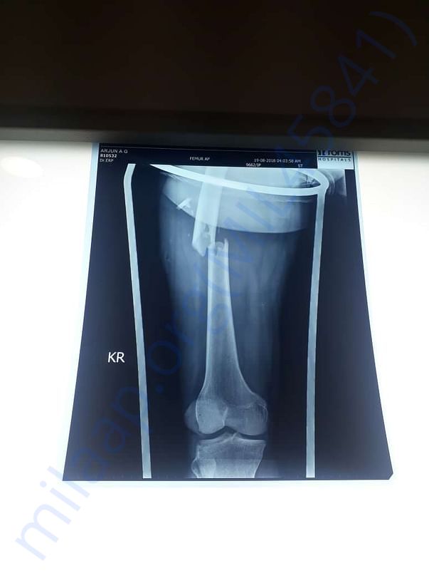 X-ray 2