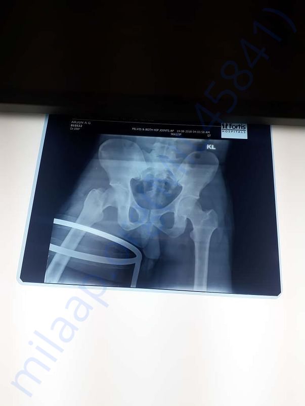 X-ray 3