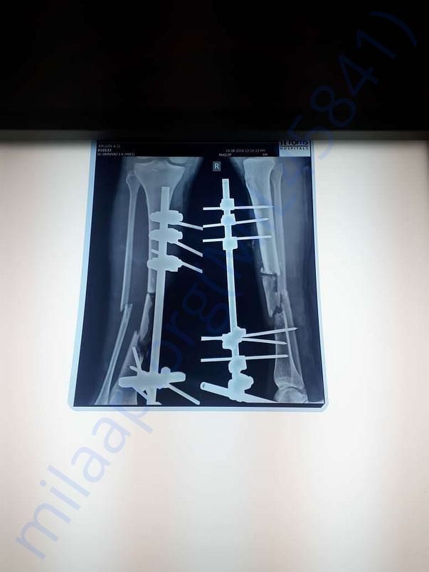 X-ray 4