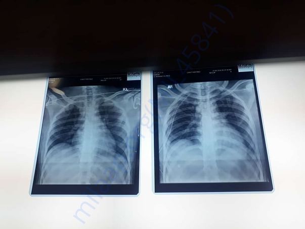 X-ray 6