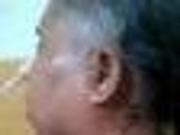 Help My Mother Fight Cancer