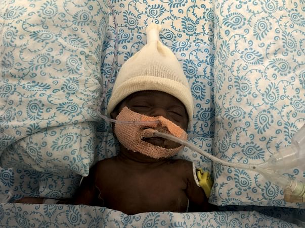 Help Mr & Mrs. Shobarani To Save Their Only Surviving Twin