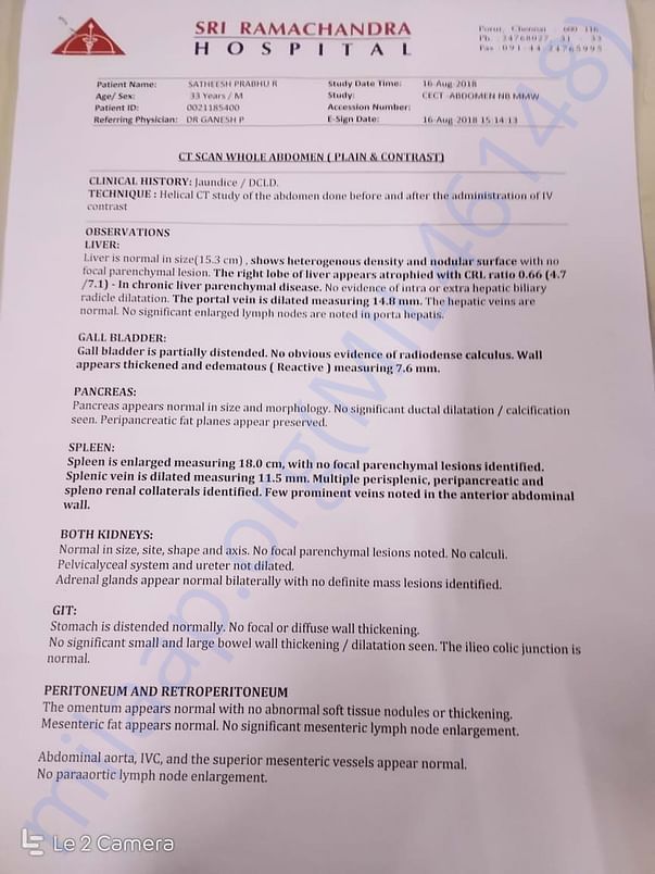 CT Scan report 1