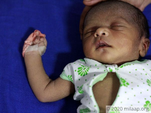 Poor Parents Cannot Afford Baby Boy's Urgent Heart Surgery