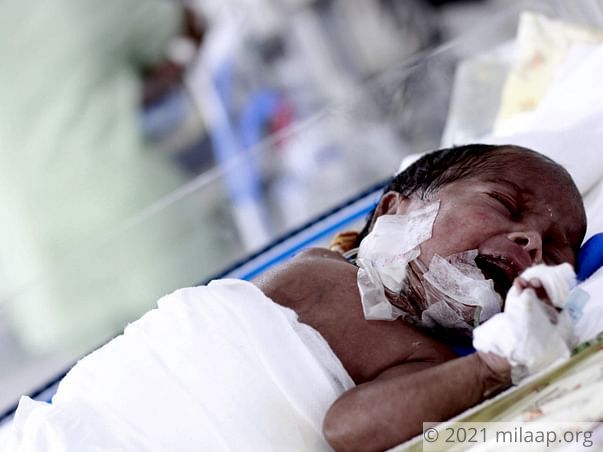 Hotel Worker Struggles To Save 2-Month-Old From Deadly Disease