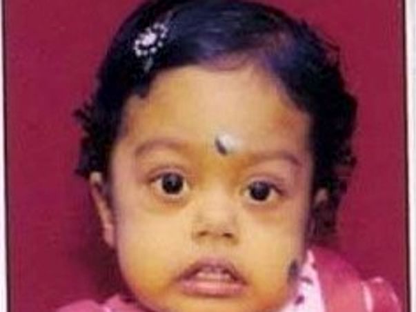 Help Baby Aaradhya to undergo Liver transplant surgery