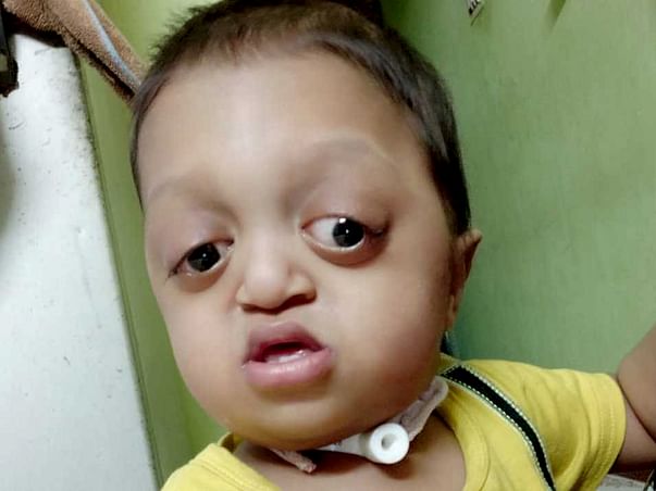 Let’s Help This Baby To Lead His Life - Muhammad Ibrahim