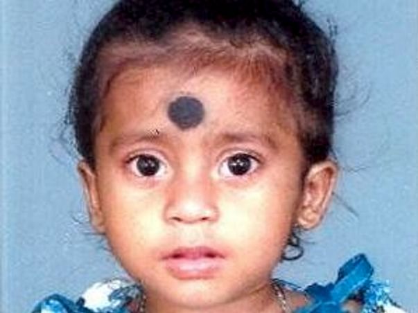 Help little Asha with her heart surgery
