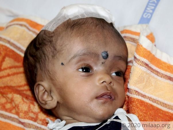 Help 5-month-old Navena suffering from severe brain infection