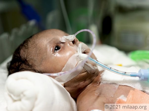 Sraveena's baby is in a critical state and needs urgent help
