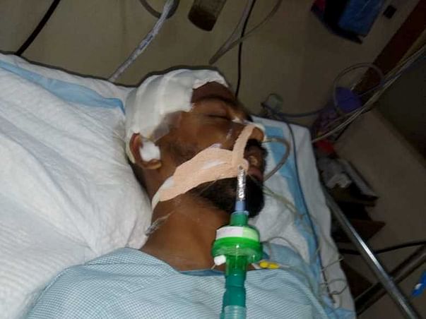 Help Saikiran Who Met With An Accident And Fighting For His Life.