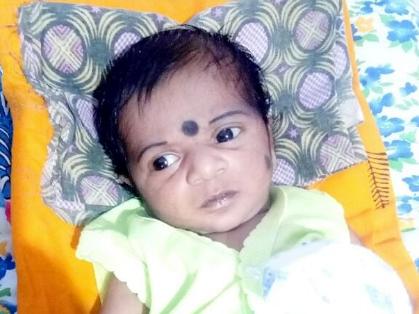 Help Baby Khavish Fight Heart Problem(TOF)