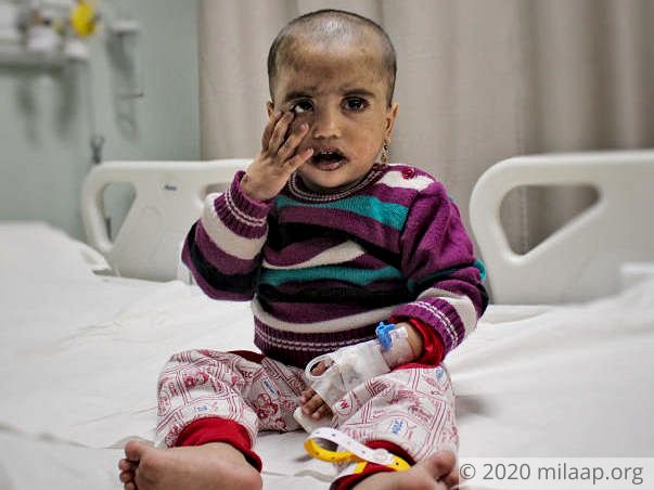2-Year-Old Who Itches Till He Bleeds Needs A Transplant Urgently