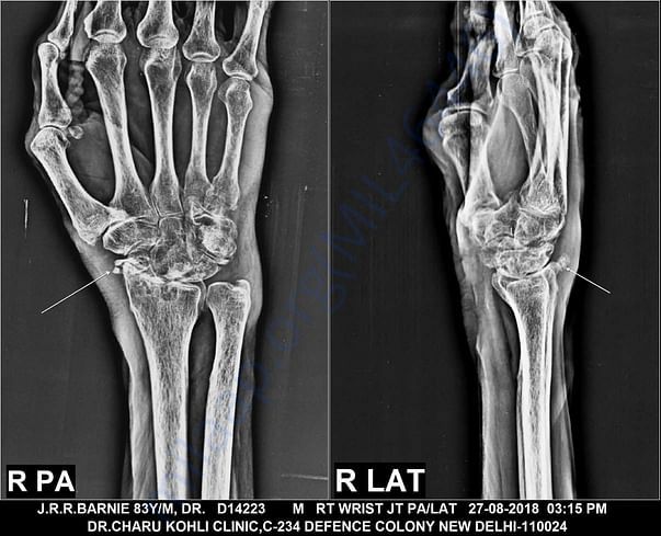 INSIDE XRAY
