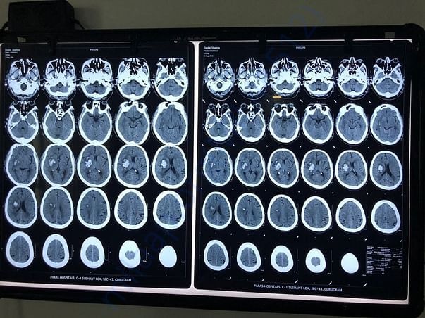 Lab Scan