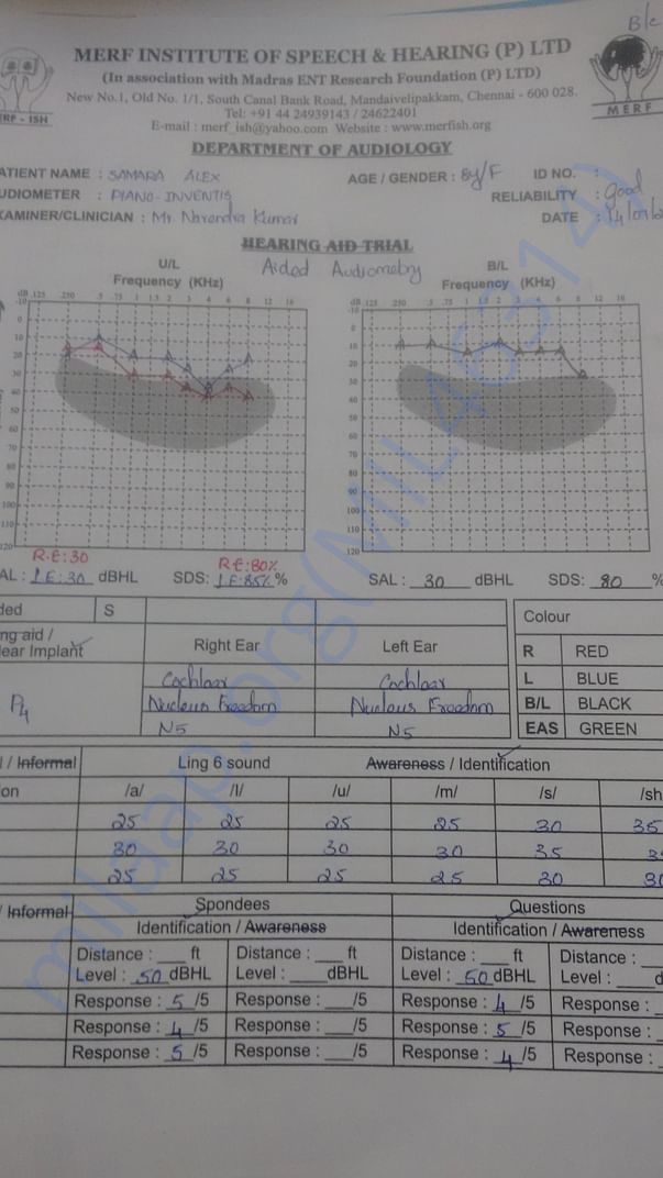 Latest audiogram