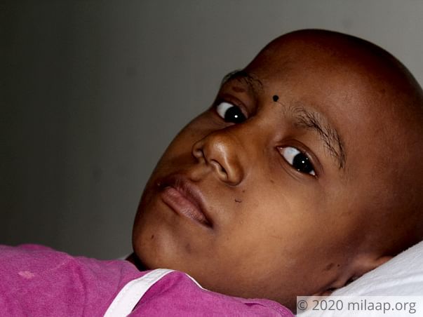 Cancer Has Taken Away This 10-Year-Old's Hair, But Not Her Spirit