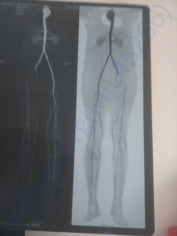 Reports & Discharge Summary for 3 Surgeries